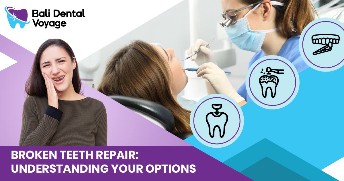 Cheapest Way to Repair Broken Teeth - Cheapest Way to Fix Teeth