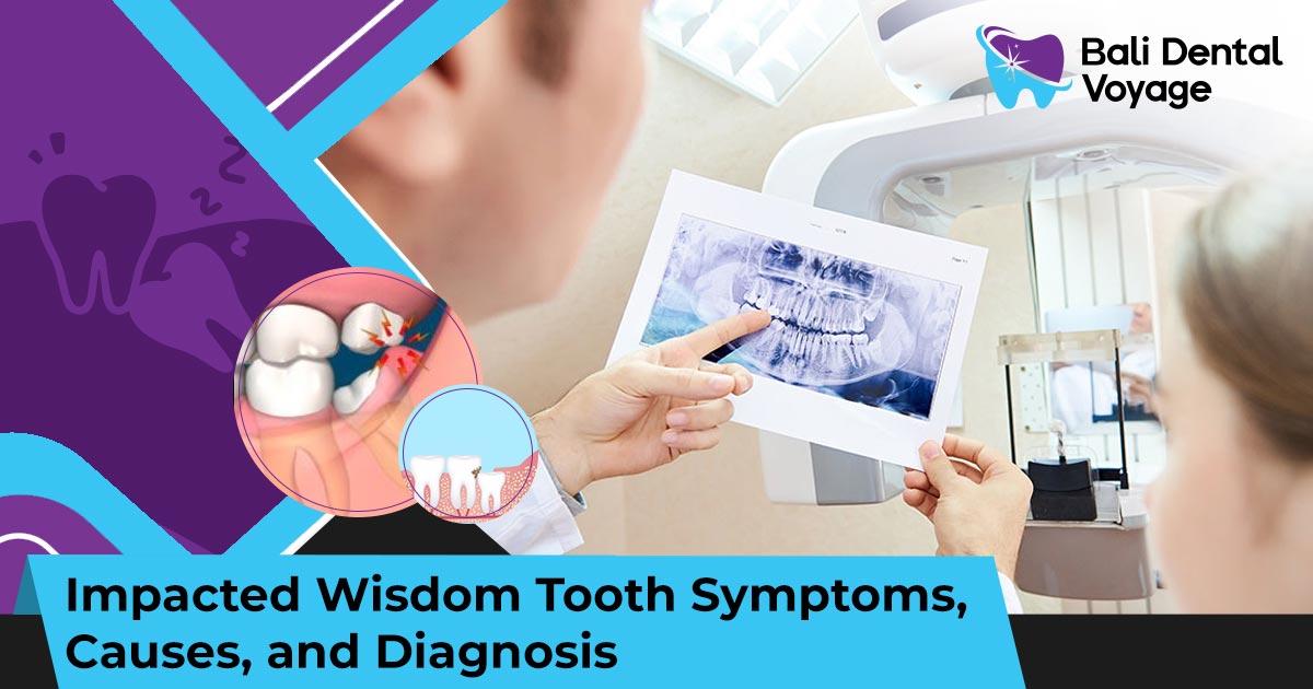 Impacted Wisdom Tooth Symptoms