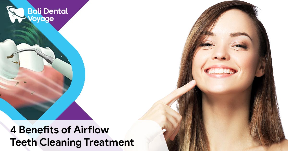airflow teeth cleaning benefits