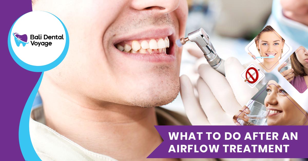 airflow teeth cleaning aftercare