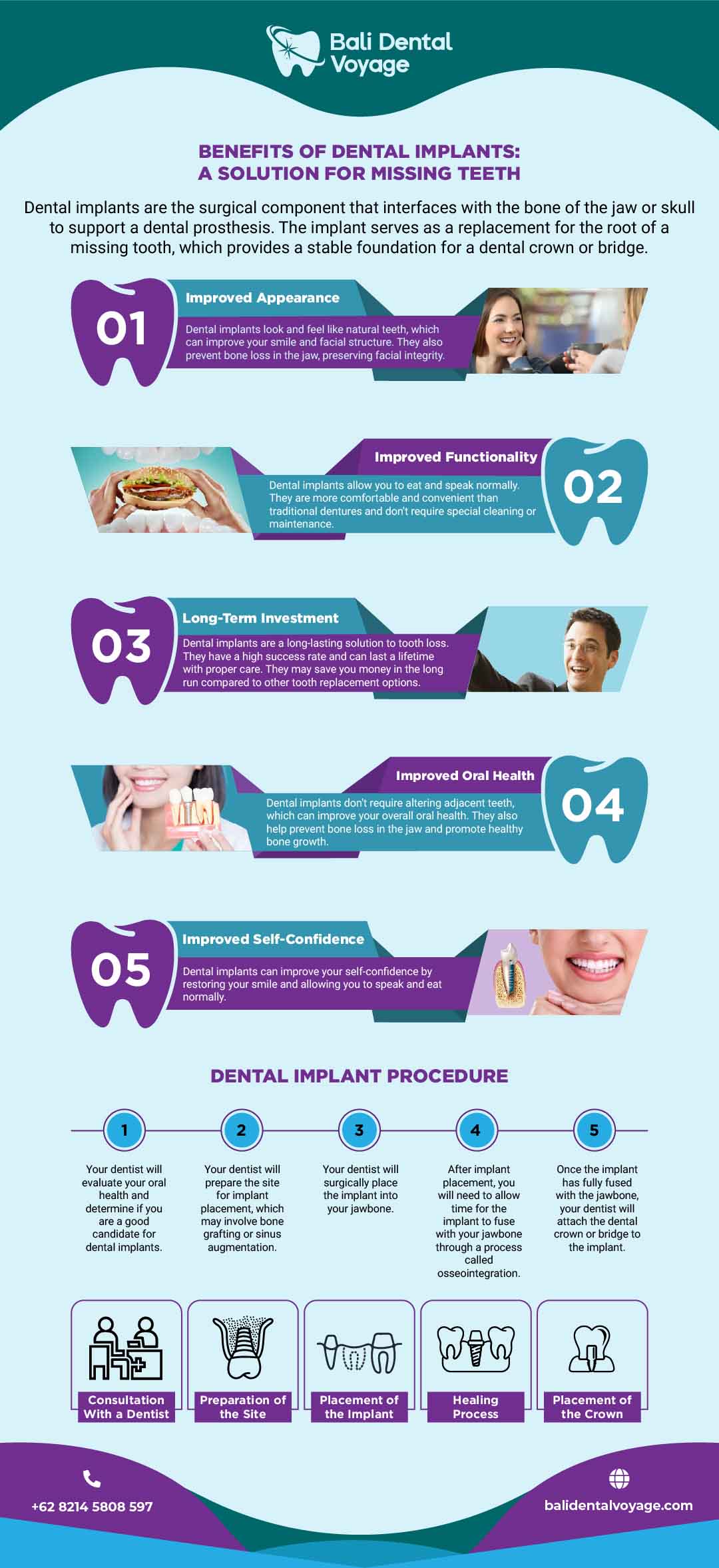 2 Types of Dental Implants - Dental Implants Types