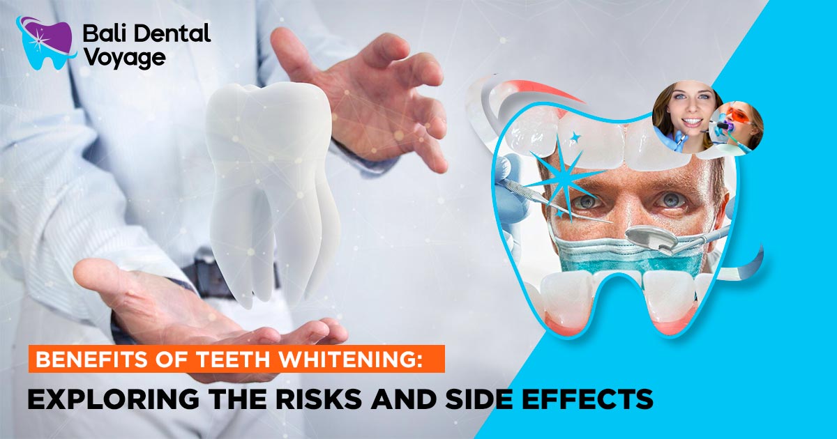 Benefits of Teeth Whitening: Exploring the Risks and Side Effects