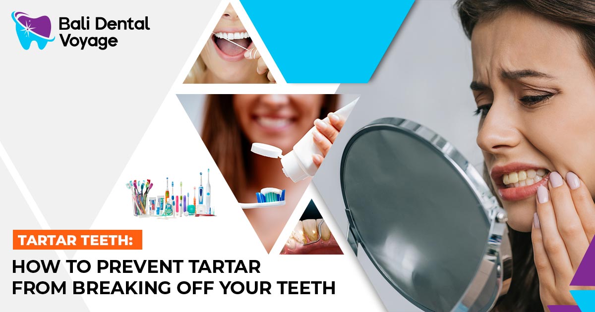 Tartar Teeth: How to Prevent Tartar From Breaking Off Your Teeth