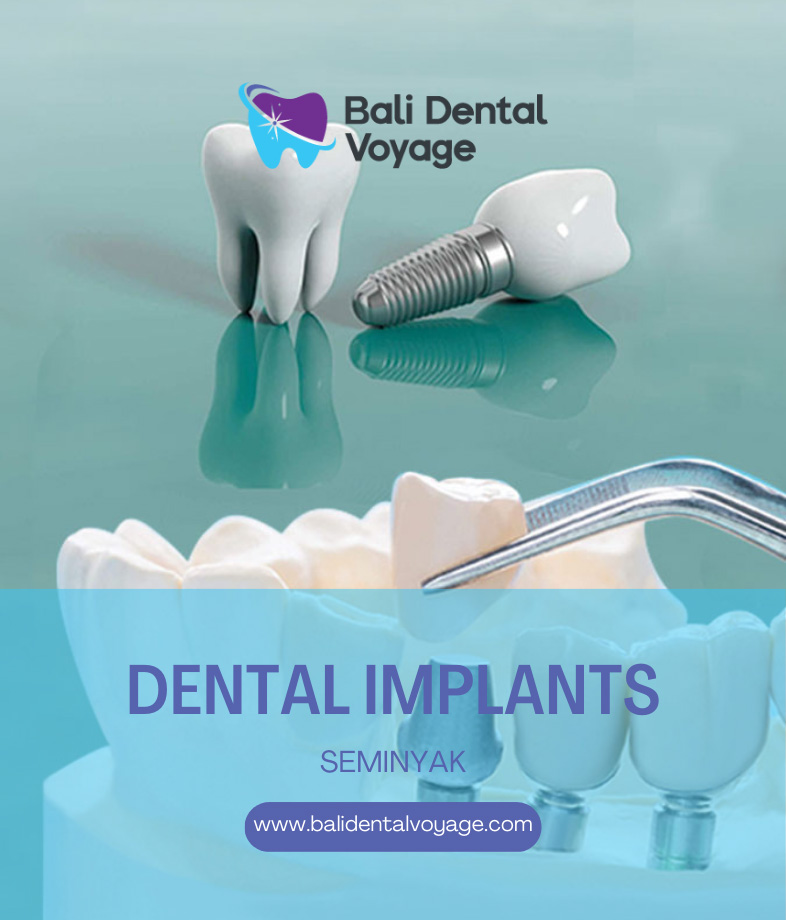 bali dental implants seminyak