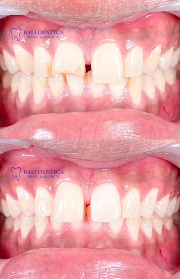 Cosmetic Dentistry Results 3