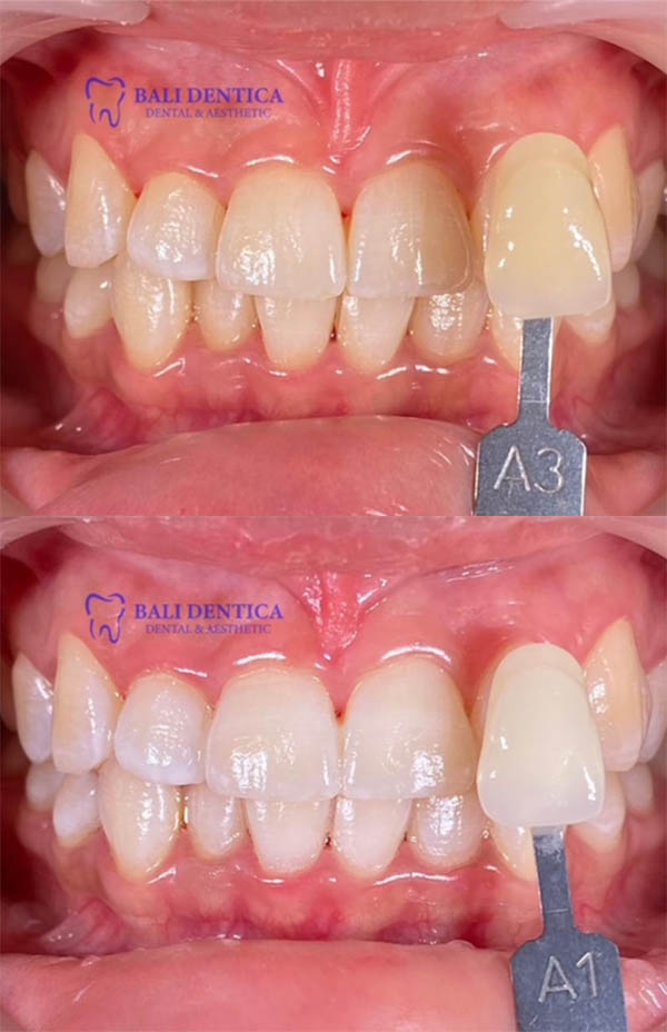 Cosmetic Dentistry Results 2