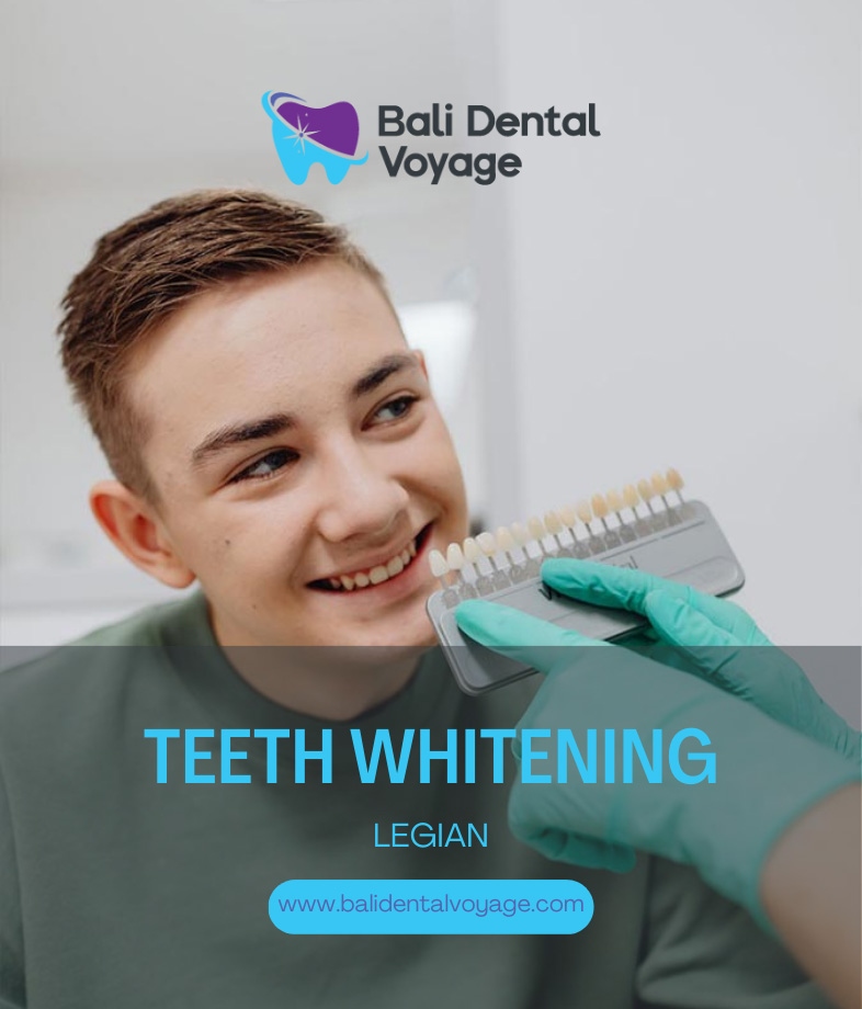 teeth whitening bali legian