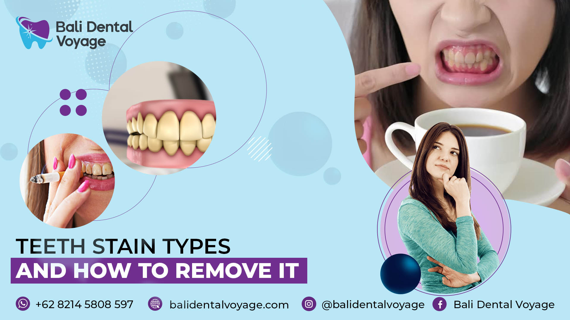 Teeth Stain Types & How to Remove It