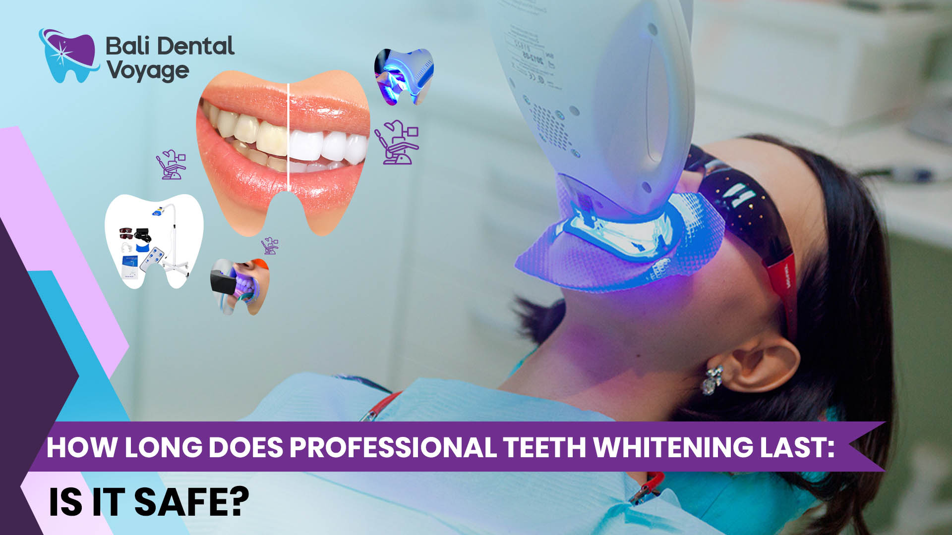 how long does professional teeth whitening last