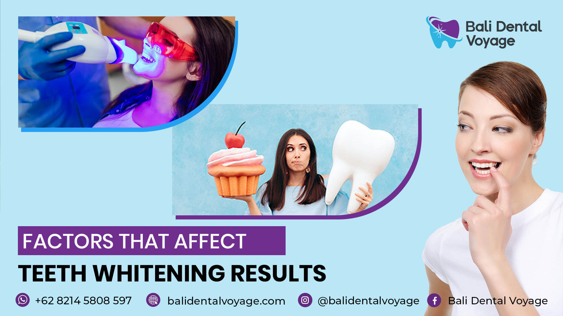 Factors That Affect Teeth Whitening Results