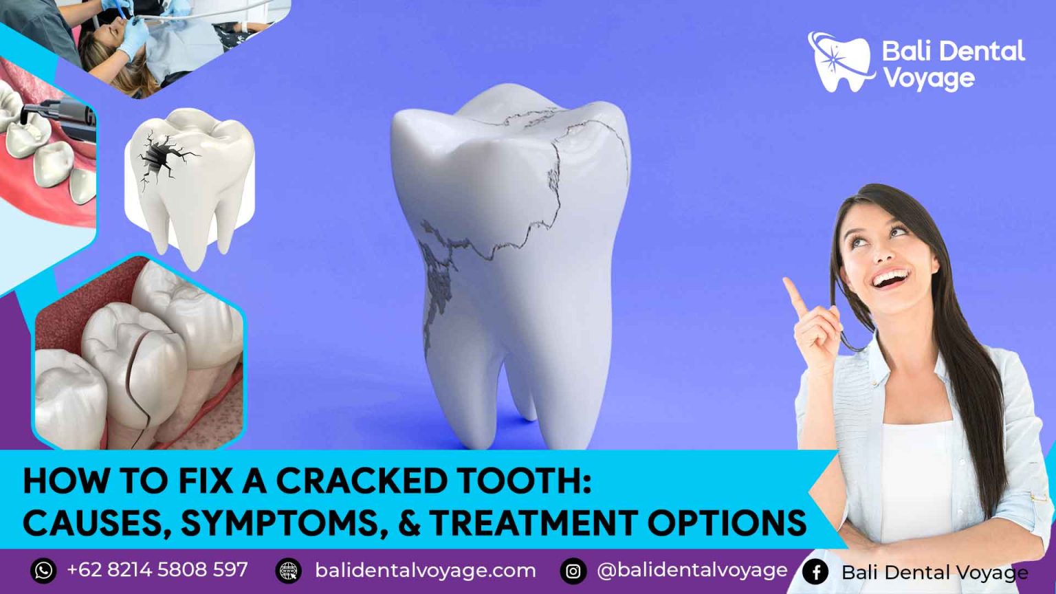 How to Fix Cracked Tooth Causes, Symptoms, & Treatments